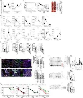 PTX3 Regulation of Inflammation, Hemostatic Response, Tissue Repair, and Resolution of Fibrosis Favors a Role in Limiting Idiopathic Pulmonary Fibrosis